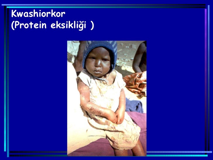 HM’den Spor Giyim Koleksiyonu 82
